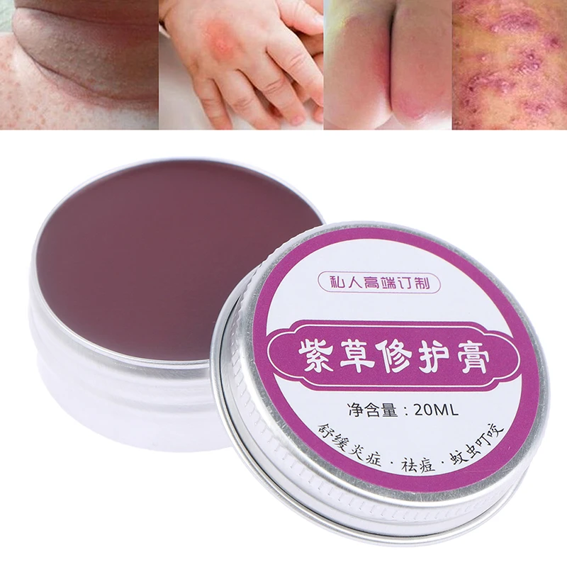 20ml Olive Oil Arnebia Repair Cream Skin Care Spots Remover Spotless Inner Thigh Relieve Pain |