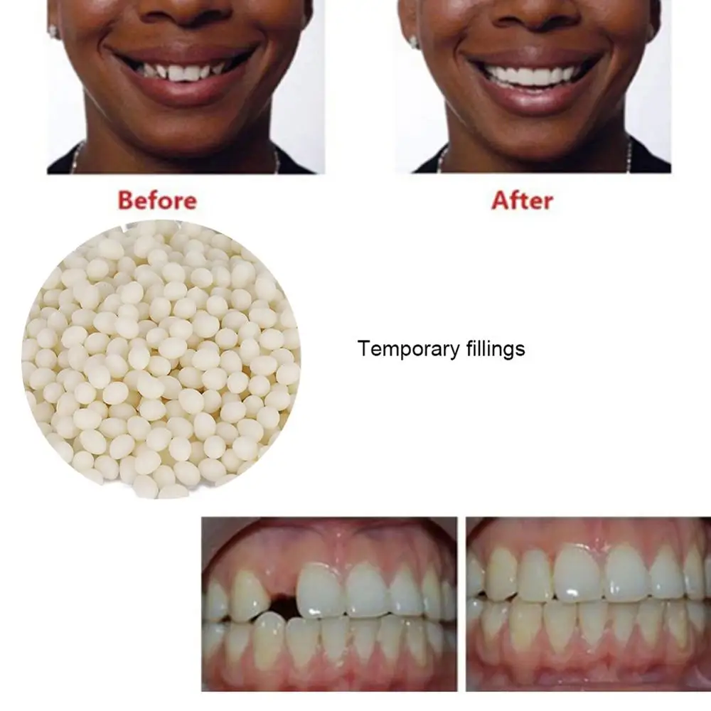 50g *2 Bag False Teeth Solid Glue Temporary Tooth Repair Gaps Filling Denture Adhesive False