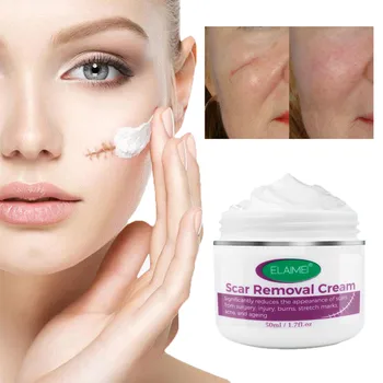 

Scar Removal Cream Stretch Marks Relief And Burns Repair Acne Mark Removal Cream Scars Acne Cream Repair Anti-aging Anti-winkles