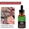 Nails-Care-Repair Nail-Fungal-Treatment Anti-Fungus Onychomycosis-Removal Liquid Ginger Foot Antifungal Nail Essence 20/30/50ml ► Photo 3/6