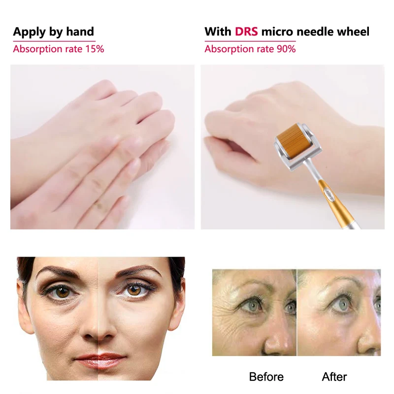 DARSONVAL 192 derma roller micro needles titanium microneedle mezoroller machine for for skin care and hair-loss treatmentDARSON