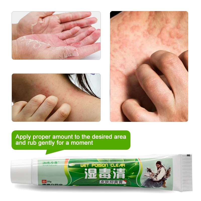 1pcs Dermatitis Eczema Antibacterial Cream Skin Psoriasis Treatment Ointment Skin Pruritus Care Relieve Cream P1058