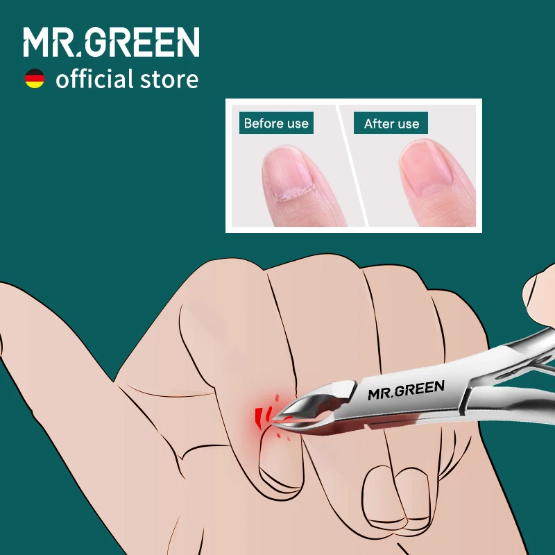 Фото Кусачки для кутикулы MR.GREEN, инструмент для удаления омертвевшей кожи, нержавеющая сталь, для педикюра №2