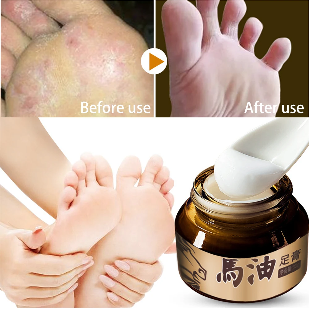 feet wrinkle cream