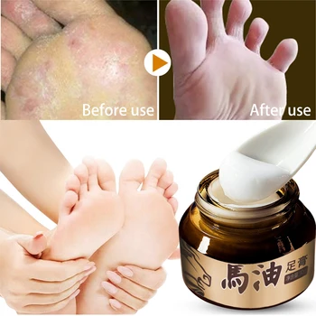 

BAIMISS Foot Cream Horse Oil Feet Care Moisturizing Anti Wrinkle Chapping Ointment Detox Treatment Repairing Whitening Skin 30g