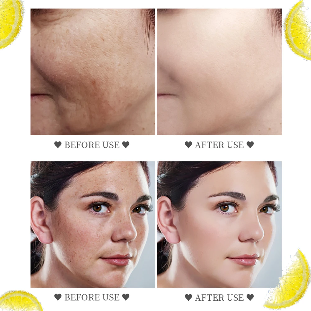 VIBRANT GLAMOUR Whitening Freckle Face Mask Vitamin C Moisturizing Anti Aging Firming Shrink Pores Brightening Mask 2