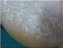 1 пара, новые гелевые носки для пятки, увлажняющие гель-содержащие спа-носки, уход за ногами, трещины, сухость ног, Жесткий протектор кожи, опт или розница