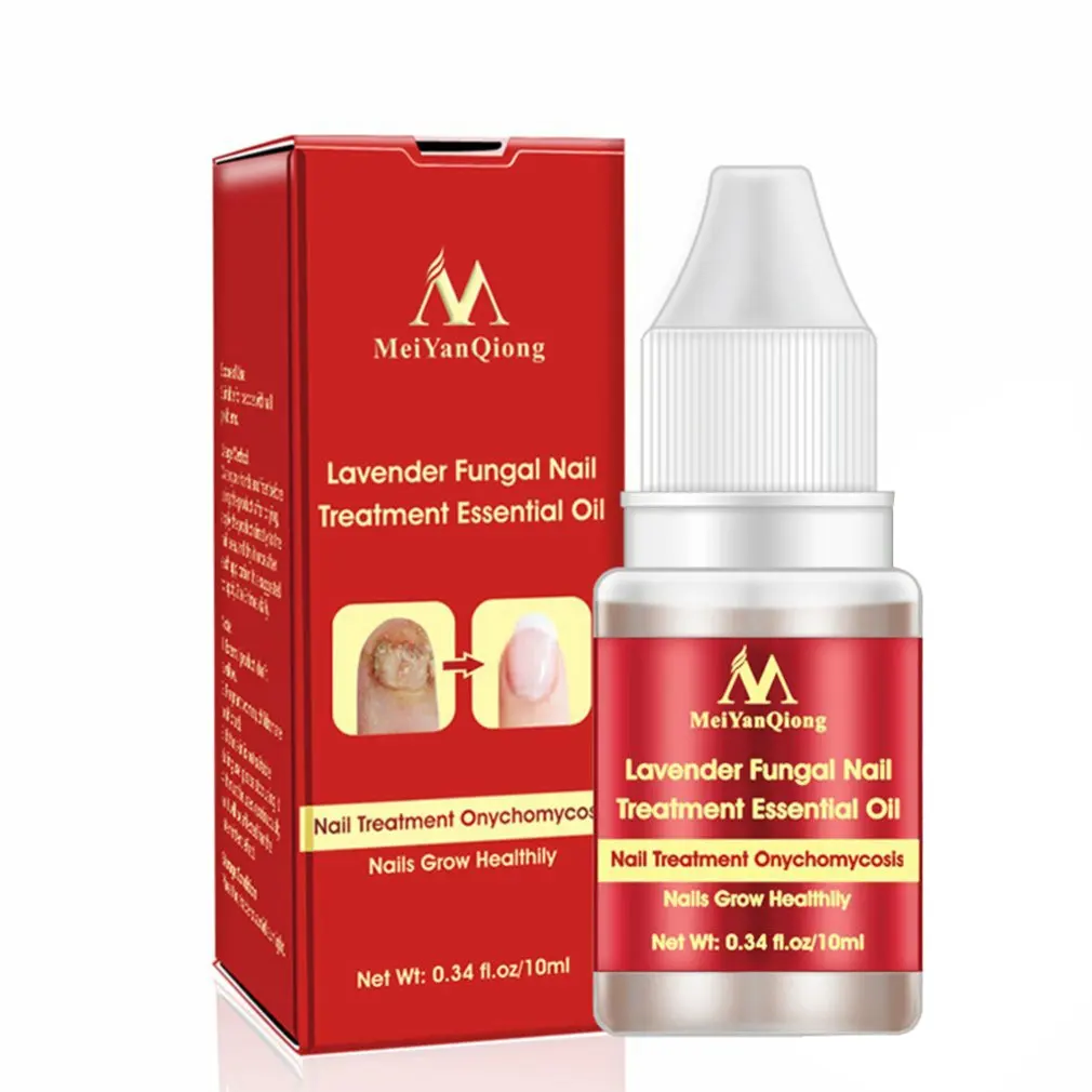 

Kill Bacteria And Fungus Nail Fungus Treatment Cream Onychomycosis Paronychia Anti Fungal Nail Infection