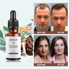Продукты против выпадения волос, лечение роста волос, масло, эссенция для волос, стимуляция масла, быстрая толщина, продукты по уходу за волосами, решения для волос