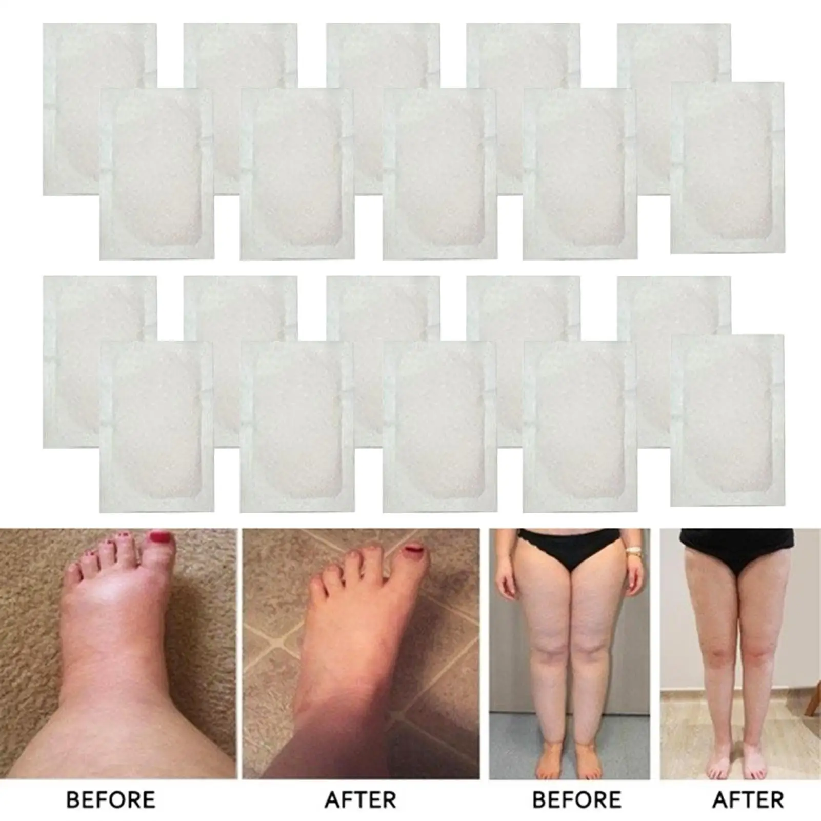 

HOT SALESï¼ï¼ï¼New Arrival 20Pcs Anti-Inflammatory Anti-Swelling Ginger Foot Care Patches Adhesive Pads
