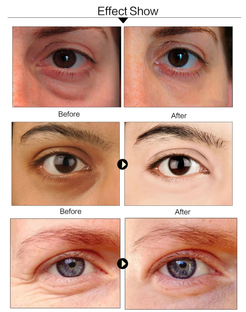 green collagen eye mask (4)