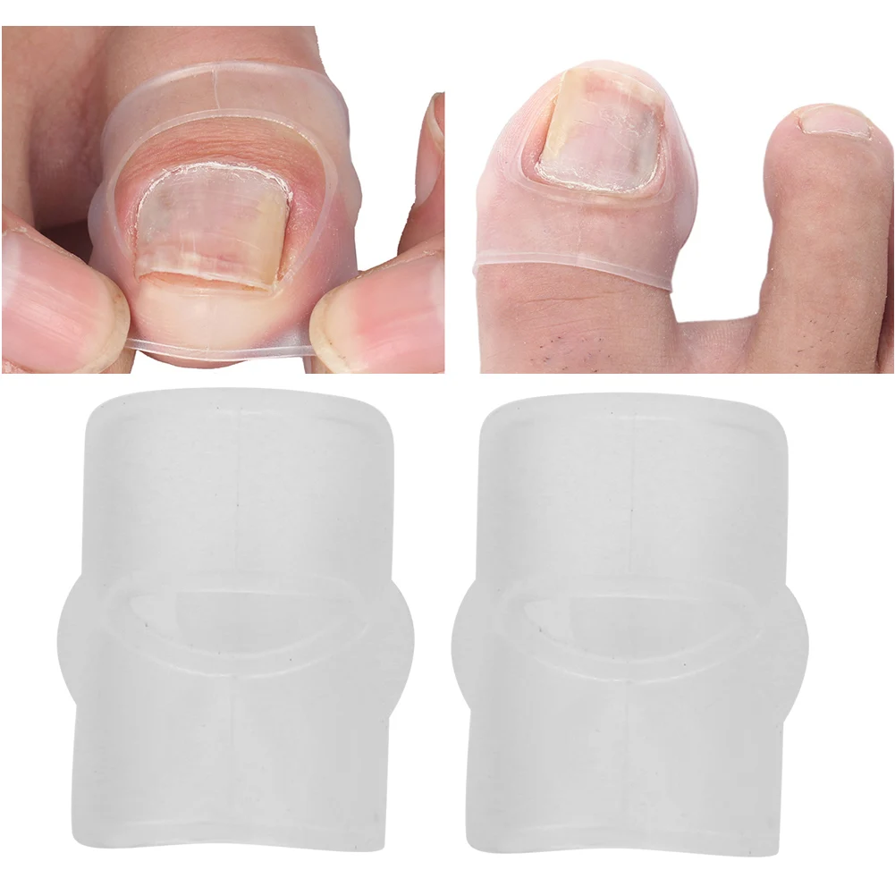2pcs Silicone Ingrown Toenail Correcting Tool Pain Relief Paronychia Treatment Corrector Invisible Silicone Inlay Corrector Care