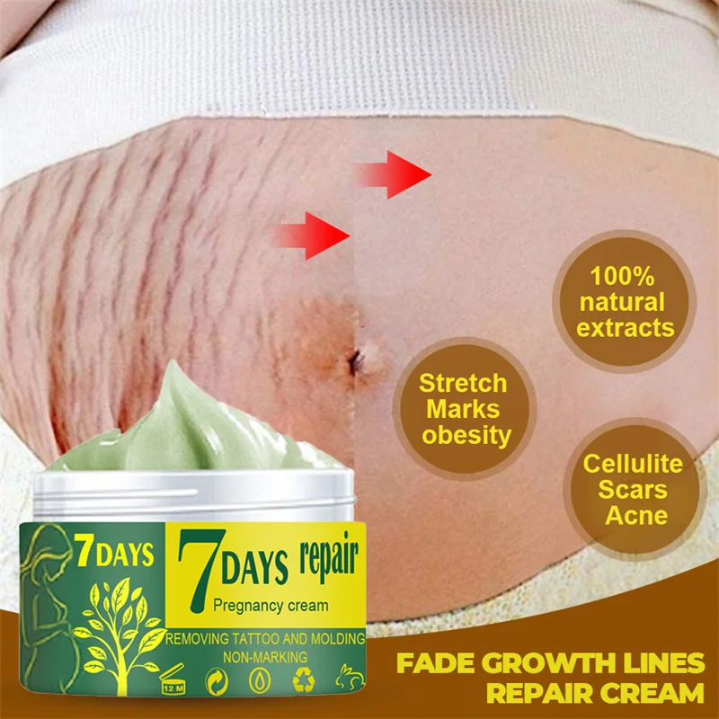 Body Lotion Slimming Cellulite Massage Remove Stretch Marks Cream