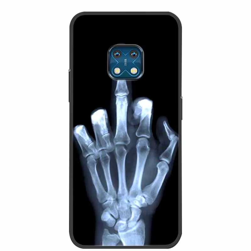 Luxurious Silicone TPU Soft Cover Phone Case - Shockproof Protective Bumper with Fruit Design