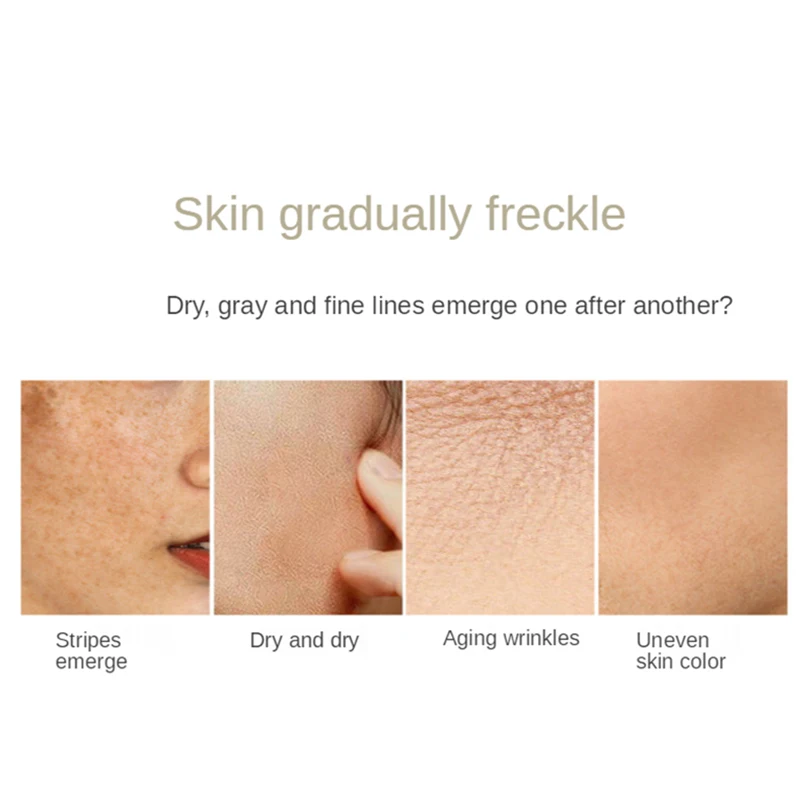 Whitening Anti Freckle Skin Care Set With Box Moisturizing Face Cream Serum Toner Lotion Nicotinamide Brighten Shrink Pores Kit