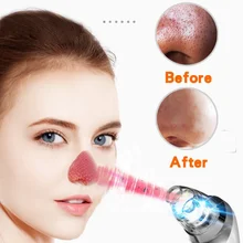 Профессиональный Электрический Очиститель пор на лице для удаления черных точек вакуумное очищающее средство для ухода за кожей лица инструмент для красоты