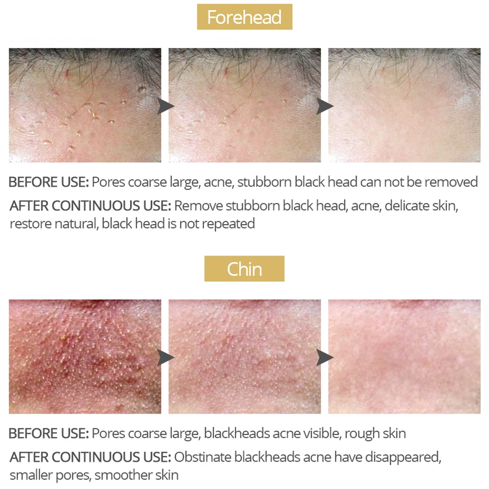 VIBRANT GLAMOUR Nose MaskNew Bamboo Charcoal Blackhead RemoverPore Moisturizing Peeling Mask Deep Cleansing Shrink Skin Care 3