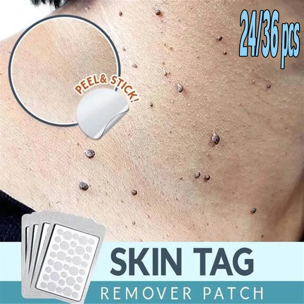Parche eliminador de marcas en la piel, parche para espinillas, yeso, crema de acné, Invisible, hidrocoloide, granos, maestro, antiinfección, absorbe el cuidado de la cara