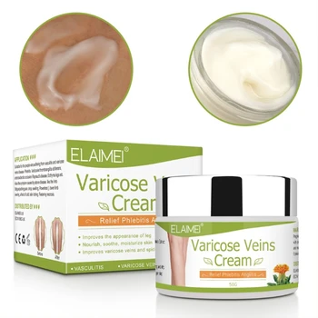 

50g Varicose Veins Cream Phlebitis Angiitis Treatment Pain Relief Effective Improve Inflammation Rotten Legs Nourish Ointment Pl