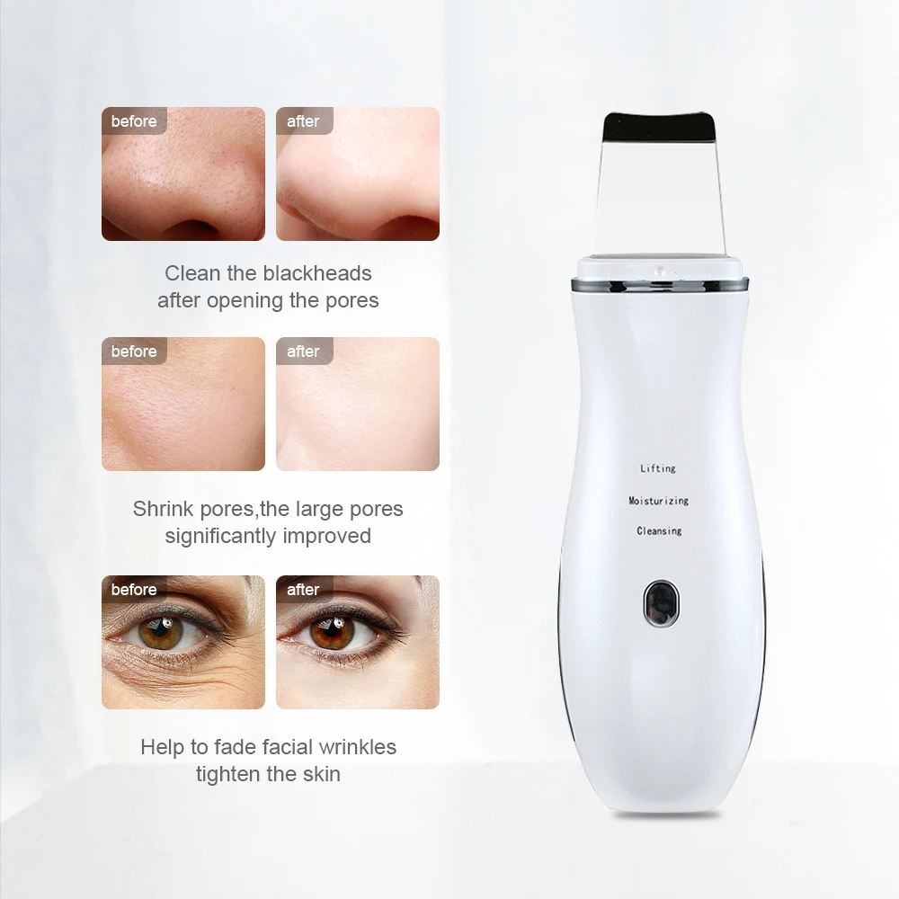 Ultrasonic Skin Scrubber Peeling Shovel Ion Acne Blackhead Remover Deep Face Cleaning Machine face Lifting Facial Massager