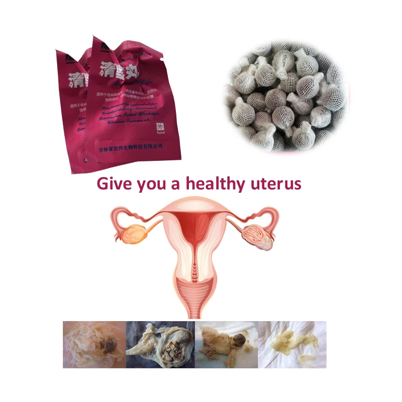 Красивая жизнь тампоны иони жемчуг Аппликаторы женский гинекологический вагинальный Детокс тампон толкатель китайский сброс токсинов