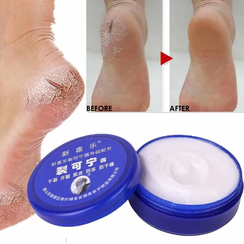 Chinese Oil Anti-Drying Crack Foot Cream Heel Cracked Repair Cream Removal Dead Skin Hand Feet Care Ointment 33g