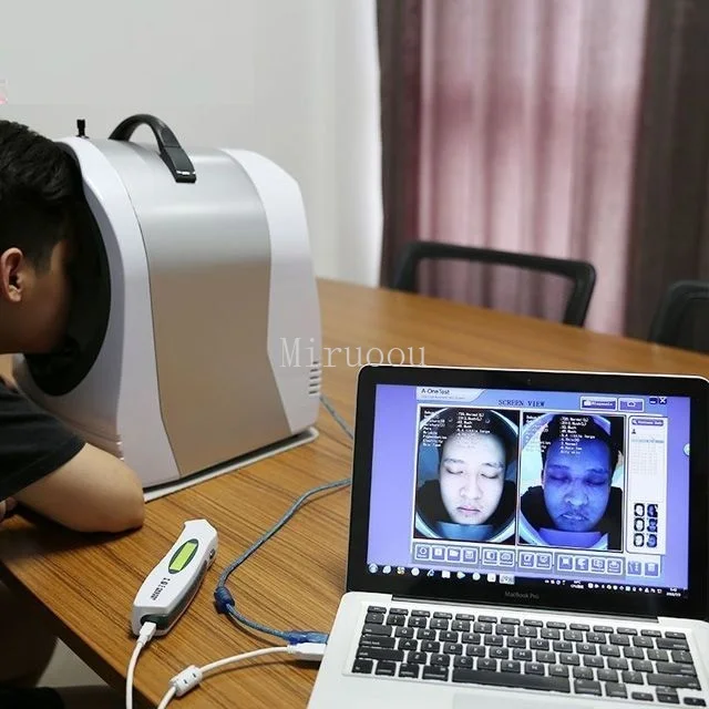  Mirror Face Led Watch Facial Reveal Imager Skin Analyzer Analysis High Resolution Camera Provide De - 4000156284755