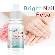 Гель для удаления грибка для ногтей с травами и питательными веществами, гель для удаления грибка для ног, уход за ногами, отбеливание ног, яркий, анти-инфекционный