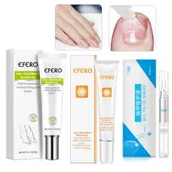 3/5pcs Fungal Nail Repair Essence Serum Toe Nail Fungus Treatment Nails Gel Anti Infection Paronychia Onychomycosis Feet Care