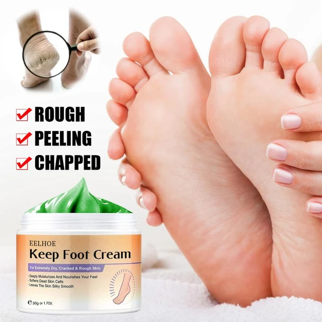 15/30/50g doğal bitkisel etkili ayak kremi Anti-crack Anti-Aging ayak kremi  derin nemlendirici pul pul kırışıklık karşıtı ayak bakımı - AliExpress