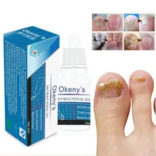 Средство для лечения грибка ногтей Уход за ногами отбеливающая эссенция для пальцев ног против грибка