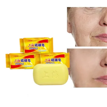 

Treatment of Acne Fungi with High Quality Chinese Medicine Skin Soap Protecting Skin Hand Soap Against Aging Skin Black Spots