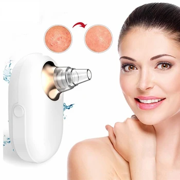 

Electric Vacuum acne pore cleaner woodpecker Blackhead pimple cleaning instrument beauty remover Facial skin care Deep clean