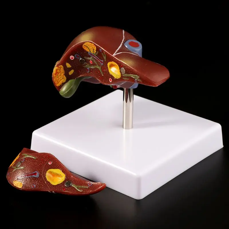 

Human Liver Pathological Anatomical Model Anatomy School Medical Teaching Display Tool Lab Equipment