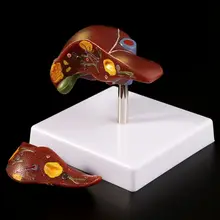 Human Liver Pathological Anatomical Model Anatomy School Medical Teaching Display Tool Lab Equipment 1 1 pvc high quality cardiac anatomy model medical teaching tool art tool instructional tool clinic figurines