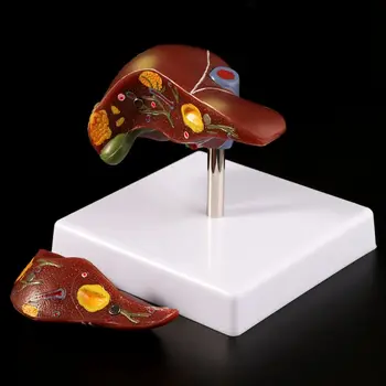Human Liver Pathological Anatomical Model Anatomy School Medical Teaching Display Tool Lab Equipment 1 1 pvc high quality cardiac anatomy model medical teaching tool art tool instructional tool clinic figurines