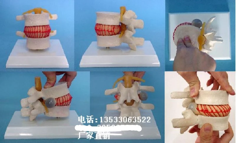 

vertebra Under pressure Demo model spine Skeleton model free shipping