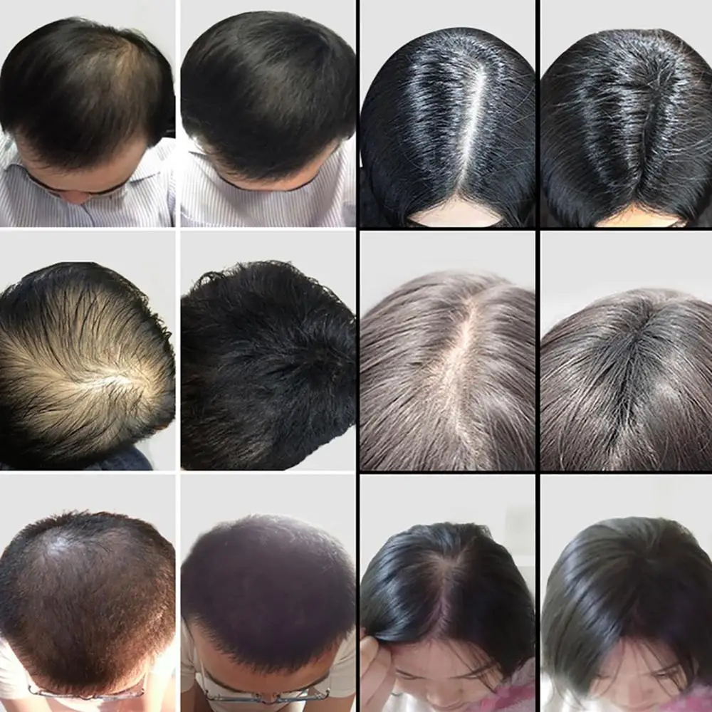 Кератиновые Волокна Для Волос Купить