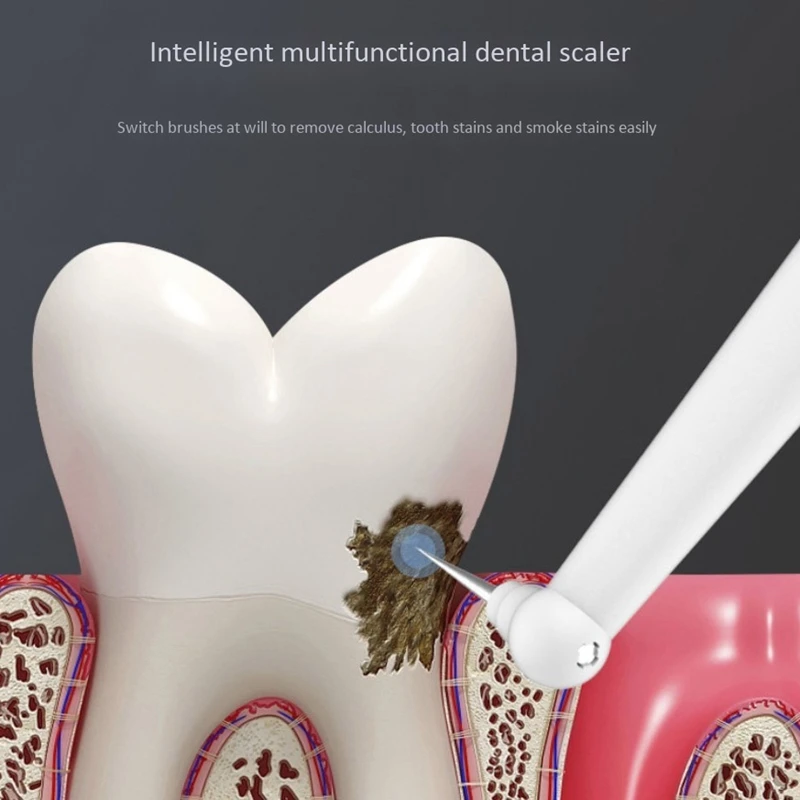 2In1Multi-Function Electric Toothbrush Flosser Tooth Cleaner Calculus Teeth Cleaning Whitening Device 2In1Multi-Function Electric Toothbrush Flosser Tooth Cleaner Calculus Teeth Cleaning Whitening Device