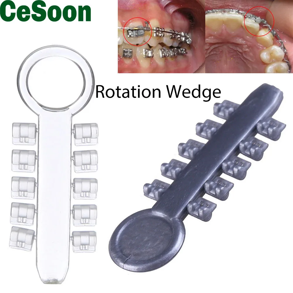 Cuñas de rotación de ortodoncia Dental, bandas de goma elásticas