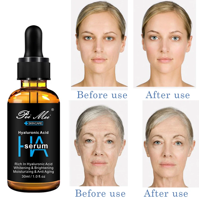 Suero Facial de ácido hialurónico, esencia para el rostro que hidrata los poros, reduce el antienvejecimiento, mejora la piel seca, blanquea la piel líquida, 30ml