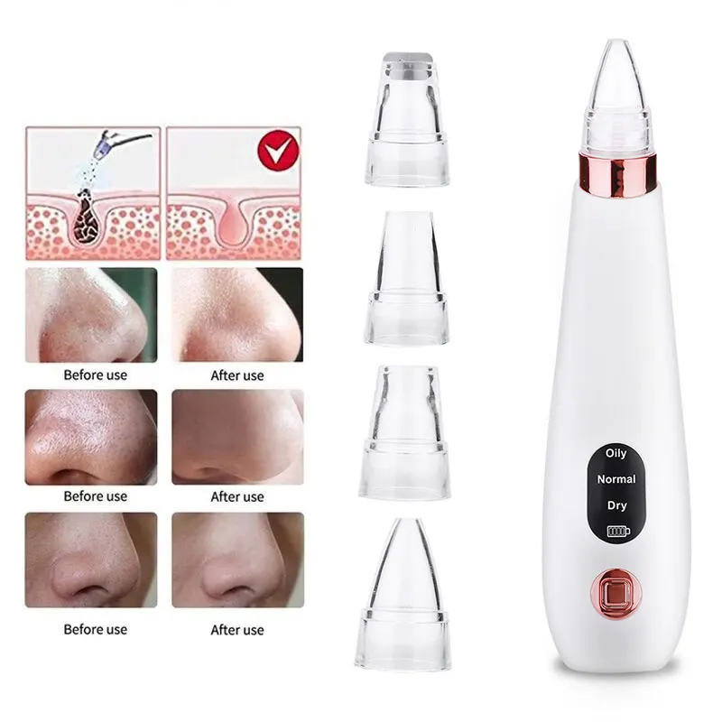 

Facial Pore Blackhead Removal Equipment Vacuum black points Suction Cleaner Acne Pimple Remove appliances aspirateur point noir