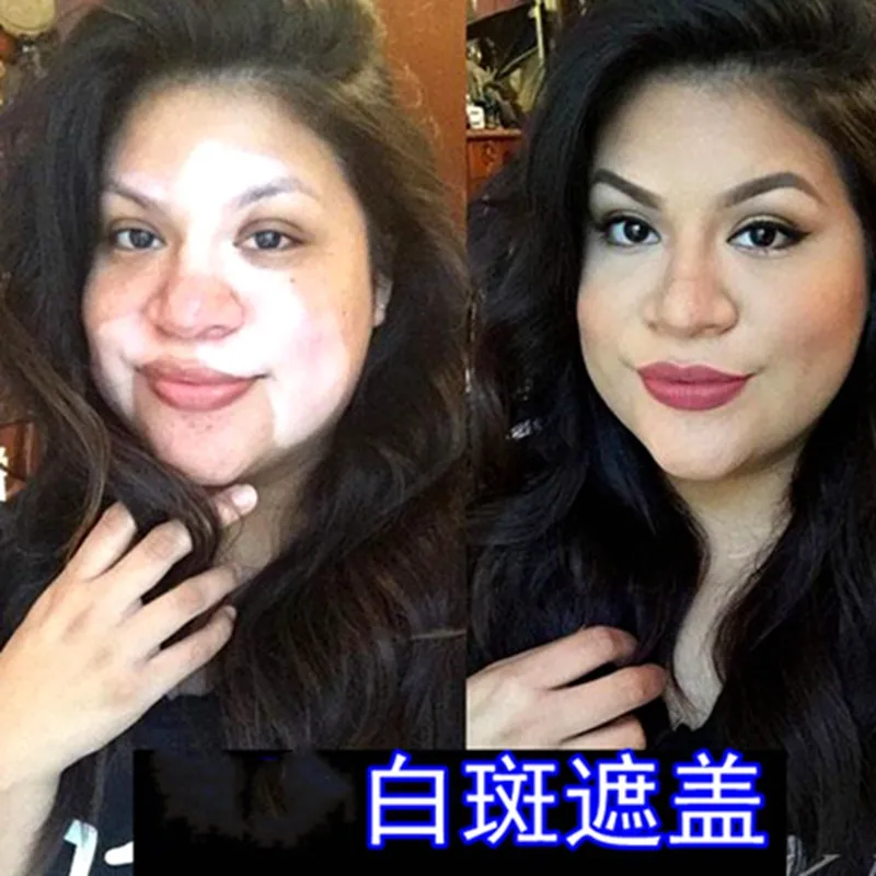 

White spot skin masking liquid waterproof concealer long-lasting topical cream cream melanin