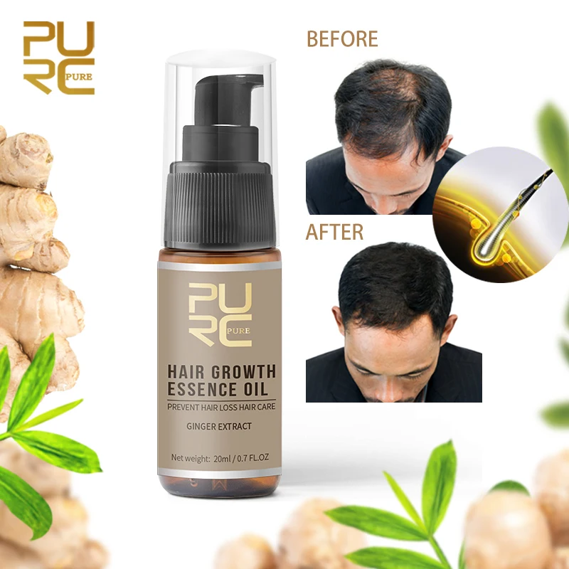 Mejores Ofertas PURC, esencia de rápido crecimiento de pelo, aceite, tratamiento para la pérdida de cabello, ayuda al cuidado del cabello, 20ml, gran oferta, Reino Unido 1zWEq33g9
