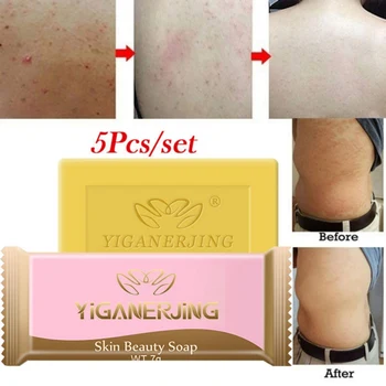 

Sulfur soap 7g*5 Whitening cleanser Chinese traditional Skin care oil-control treatment blackhead remover soap
