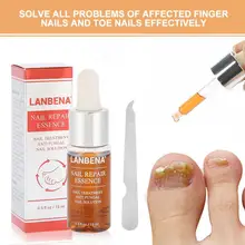 15 мл натуральный мощный ремонт ногтей эссенция анти-грибок ногтей Лечение эффективное восстановление решение