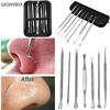 3 4 5 7 8 Pc Stainless Steel Blackhead Remover Tool Kit Face Massage Whitehead Pimple Spot Comedone Acne Extractor Face Massager ► Photo 2/6
