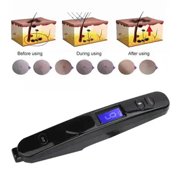 

9 Modes Adjustable Tattoo Scar Spot Freckle Removal Pen Skin Beauty Machine Tattoo Supplie Dark Spot Remover Salon Tool