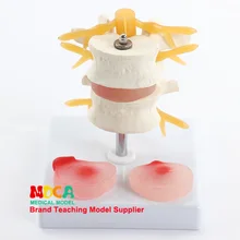 Два поясничных позвоночника межпозвоночного диска человеческий скелет позвоночника модель раздел медицина обучение Myz001