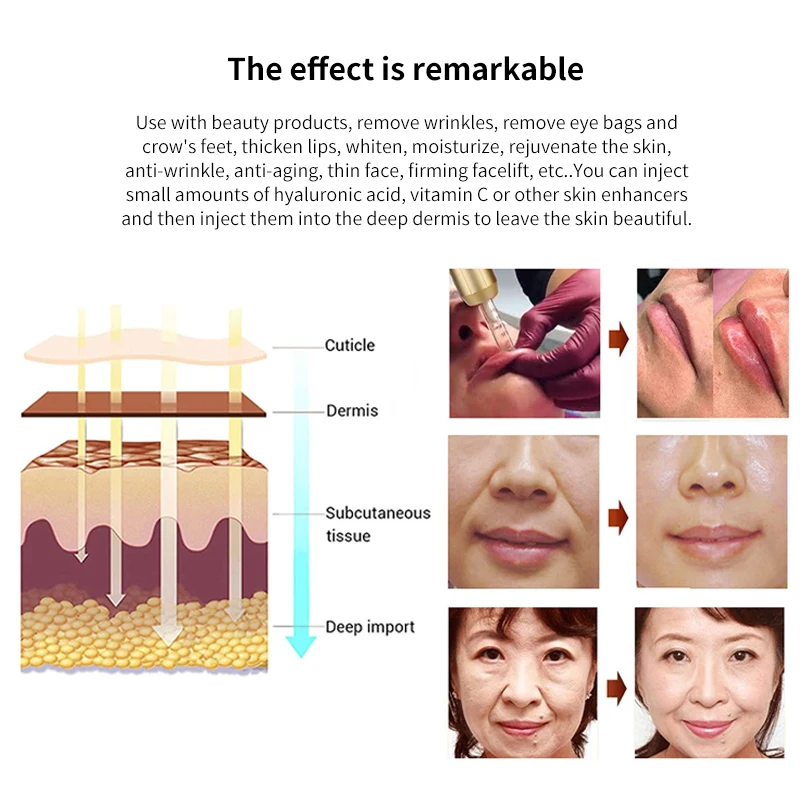 Hyaluronic Acid Pen 2 IN 1 High Pressure Hyaluron Acid Pen Anti Wrinkle Lip Injection Hyaluron Gun Face Atomizer Tattoo Supplies Pen